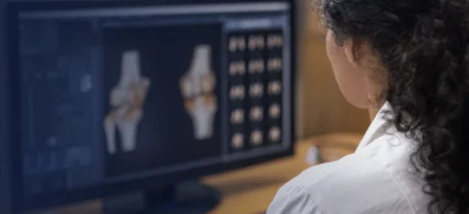 an image of a physician reading a Springbok scan